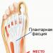 Heel Spur: Causes and Treatments