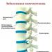 Pinched nerve in the spine and its treatment