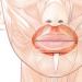 Muscles surrounding the opening of the mouth Levator anguli oris superioris