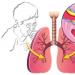 Acute bronchitis: main causes, symptoms, methods of diagnosis and treatment 2 clinical picture of chronic bronchitis main symptoms